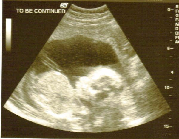 ultrasound2.jpg